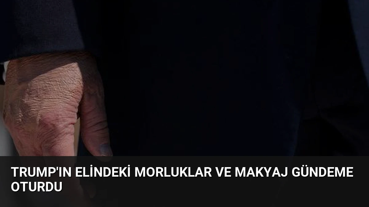 Trump’ın Elindeki Morluklar ve Makyaj Gündeme Oturdu